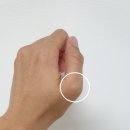 큰마디큰병원 | 경주 큰마디병원 일요일 내원 후기