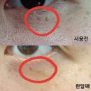 인셀덤빅토리 - 단양군 | 인셀덤 후기 - 최미희 점장님