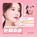 수 성형외과의원 이미지
