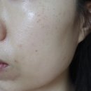 인셀덤 보네르