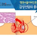 갑상선암 흔한 갑상선유두암 초기증상과 치료법 이미지