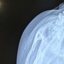 센트럴정형외과의원 이미지