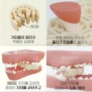 바로덴탈 이미지