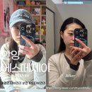 제이 | 호계동 피부관리 모공 축소엔 에스떼제이 솔직후기