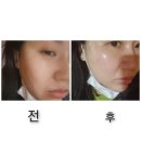 강혜경 에스테틱 | 명지 피부관리 는 강혜경 에스테틱,추천!