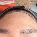 세라헤어라인 이미지