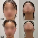 결혼상담 관리사 2급 | 수원 웨딩관리추천 아나토미 얼굴비대칭관리후기