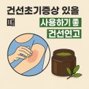 천마약품 | 건선초기증상 있을때 사용하기 좋은 건선연고
