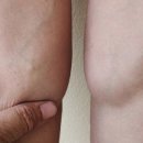 전신순환 필라테스 이미지