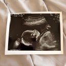 순천향대학병원 버스정류소 | 순천향대학병원 산부인과 임당검사/서울순천향병원 산부인과/임당검사 후기/임당검사 방법/서울...