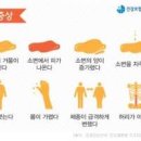 신부전증 증상 및 원인과 치료 급성 만성 말기 포함 이미지