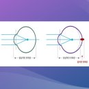 아이블레스안경 이미지