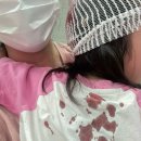 아기 머리 찢어짐 응급실 후기 : CT 검사부터 스테이플러 봉합, 제거까지 치료 과정