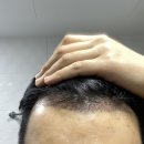 모바른의원 이미지