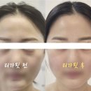 우리동네힐링샵 달동점 | 울산 달동 피부관리 윤곽 리프팅 경락 바디엘에스테틱