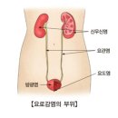 여성 60% 경험하는 요로 감염 예방법 이미지