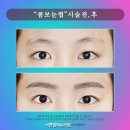 눈썹예쁨