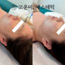 고운미 피부관리