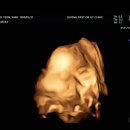 세종제일산부인과의원 | 세종제일산부인과 임당검사 후기! 28주차 임당검사,시약 맛업ㅎ음...