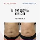 제이미스칼프