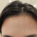 전세정독일피부과의원 | [시흥배곧 유앤아이의원] 피부과 내돈내산 방문후기(보톡스시술)🥼