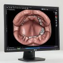 연세다정플란트치과의원 | 치아 건강, 이젠 미룰 수 없지! 연세 굿 프 란 트 치과 썰 푼다