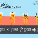 단디치과의원 네이버블로그