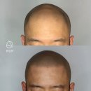 프로스칼프부산 이미지