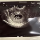 월등우체국 화장실 | [7,8주차]1.79cm 아기 초음파 젤리곰 보다! 산후조리원/자궁경부암 검사/자동차보험 자녀할인특약 신청