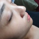 공주피부샾 네이버블로그