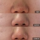 (주)참존 | 쏙모팩 후 모공관리 루틴｜나비존 모공 홈케어 4단계