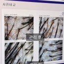 창선상가 | 산본 두피관리 닥터모락, 환절기 두피 탈모 고민 해결하고 온 솔직 후기