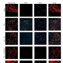 Re:Nerve Regenerative Effects of GABA-B Ligands in a Model of Neuropathic Pain 이미지