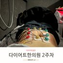 화타한의원 | 운동일상)의정부다이어트한의원 2주차후기