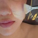 2355 | 청주 율량동 미라클 피부관리실 LDM 물방울 앰플 케어 후기