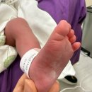 서울의료원 | 서울의료원 제왕절개 출산 후기