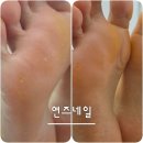 익성빌딩 | 논현 발각질 관리 잘하는 곳 패디플래닝은 연즈네일