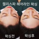 켈리스파 이미지