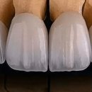 골드크라운 이미지