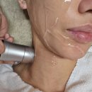 필뷰티 | 부천 상동피부관리 하이푸V라인,아쿠아필 후기 "뷰티포톤피아"