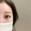 더렛빈 이미지