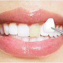 플러스치과기공소 이미지