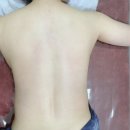도농역 맑음뷰티네일&amp;스킨케어&amp;왁싱 관리에서 테라노바 등 관리 진행 후기!