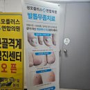 성모연합의원 | [공지] 대전 무좀내성발톱 전문병원 성모플러스연합의원 문제성발관리센터 내돈내산 레이저치료후기
