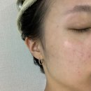 [베스티어 고객후기] 테라피 마스크팩 - 수분부족형지성 피부에도 딱이에요~!