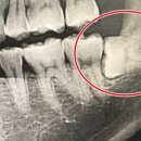 첫사랑니치과의원 이미지