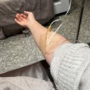 대상 | 30대 대상포진 주사 치료 후기 얼굴 증상 통증 1탄