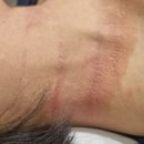 연제본한의원 | 부산아토피한의원, 스테로이드 끊으면 또 재발해서 지긋지긋한 분만 보세요