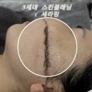 오투(O2)여성사우나 | 안산 고잔동 스킨플래닝 추천하는 이유 | 안산 신부관리 추천 | 안산 스킨플래닝은 순간 에스테틱&amp;왁싱