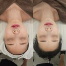 부산해운대피부관리 모어스킨, 턱선 리프팅 제대로 받고 왔어요!